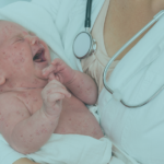 Measles Symptoms in Babies