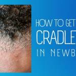 How To Get Rid of Cradle Cap in Newborns